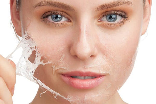 Woman peeling layer of dead skin off