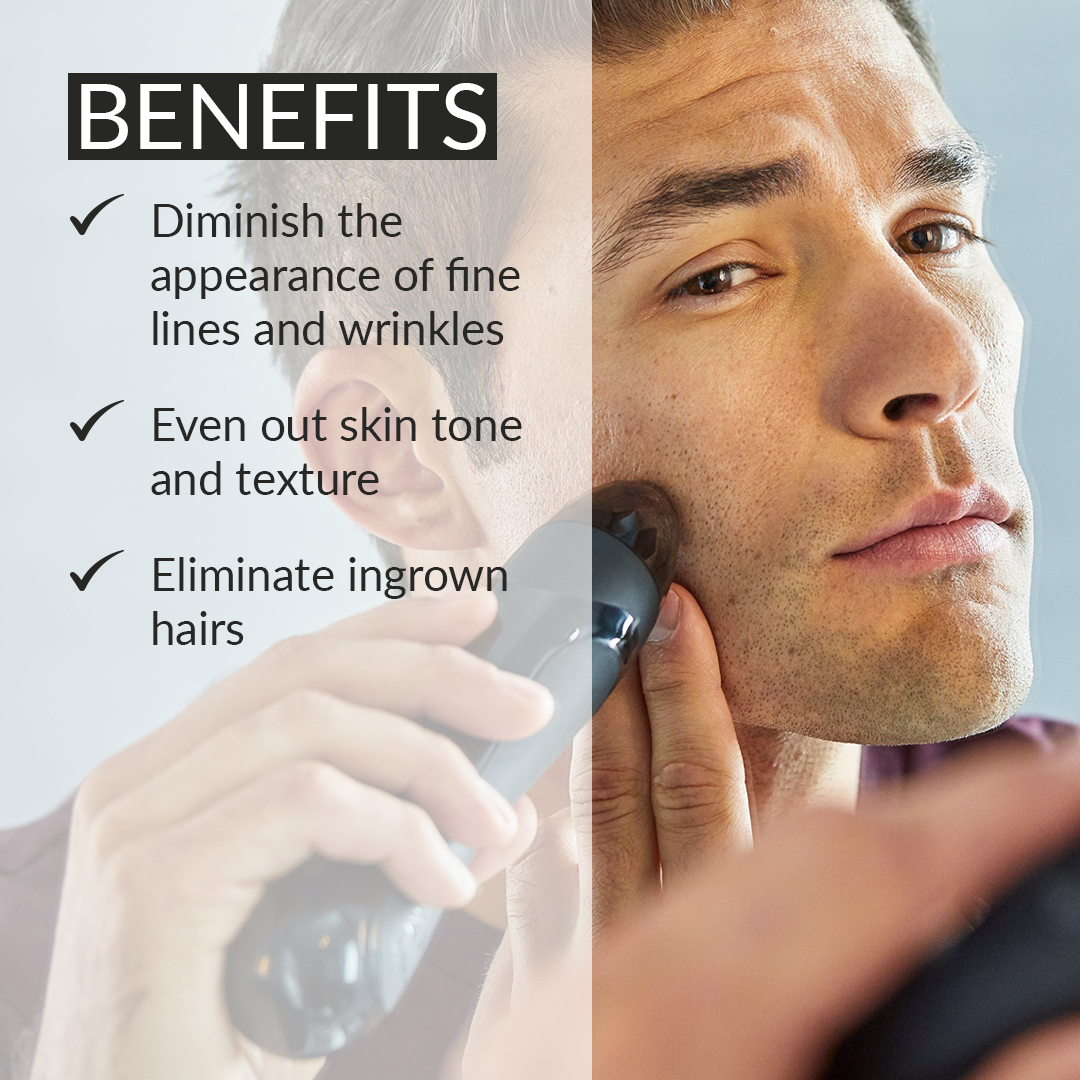 Personal Microderm Elite Pro - Black
