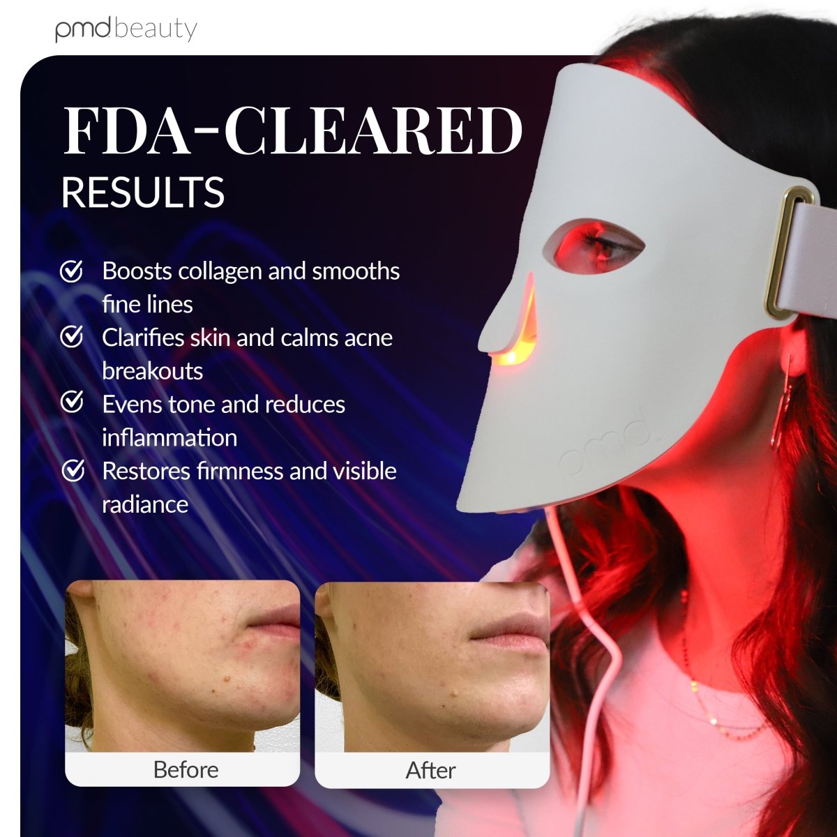 PMD LED Mask